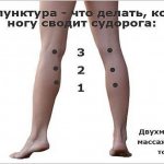 Acupuncture for leg cramps