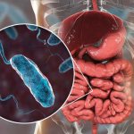 Cholera bacteria in the intestines