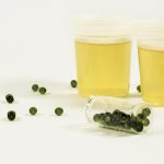 Protein in urine: causes and dangers