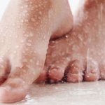 Diagnosis of foot hyperhidrosis
