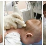 Physical diagnosis of torticollis in children of the first year of life.