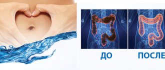 Colon hydrotherapy - colon cleansing