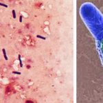 Clostridia mod microscorom have a characteristic appearance