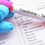 Creatinine - determination of the state of the muscular system and kidneys