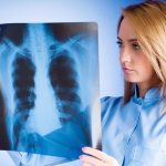 Focal pneumonia in adults: treatment, diagnosis and prevention