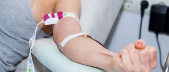 Blood plasmapheresis - Alkoklinik