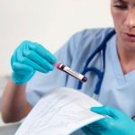 Проверка уровня мочевины в женской крови
