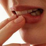 Lip cancer: symptoms and treatment