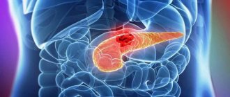 Pancreatic cancer: symptoms and treatment