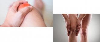 Symptoms of knee arthritis