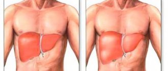 Symptoms of liver enlargement