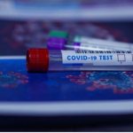 Is it worth testing for antibodies to coronavirus and where to do it in Barnaul?