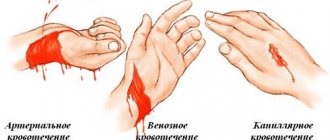 types of bleeding