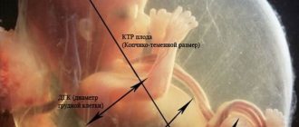 Trisomy 18/21/13: normal in the 1st trimester in pregnant women