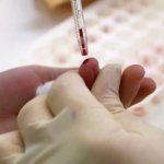 What are the differences between a general blood test and a clinical one, data decoding