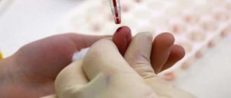 What are the differences between a general blood test and a clinical one, data decoding