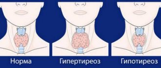 types of thyroid abnormalities