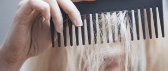 Витамины от выпадения волос: 10 самых лучших