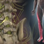 inflammation of the sciatic nerve symptoms and treatment