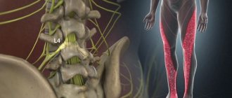 inflammation of the sciatic nerve symptoms and treatment