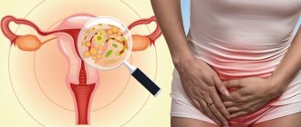 Inflammation of the female genital organs